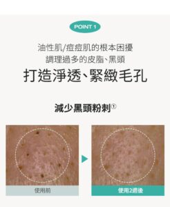 Physiogel潔美淨 積雪草Plus+控油調理精華 50ml